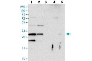 Western blot analysis of Lane 1: RT-4, Lane 2: U-251 MG, Lane 3: Human Plasma, Lane 4: Liver, Lane 5: Tonsil with FAM125A polyclonal antibody  at 1:100-1:250 dilution. (FAM125A anticorps)