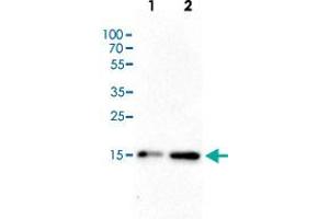 Western Blot (Cell lysate) analysis of (1) 25 ug whole cell extracts of Hela cells, (2) 15 ug histone extracts of Hela cells.