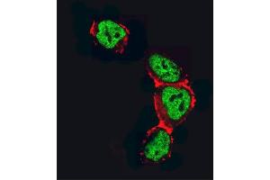 Confocal immunofluorescent analysis of HDAC2 Antibody (C-term) (ABIN6242378 and ABIN6577318) with 293 cell followed by Alexa Fluor 488-conjugated goat anti-rabbit lgG (green). (HDAC2 anticorps  (C-Term))