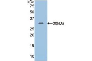 Detection of Recombinant PLS3, Human using Polyclonal Antibody to Plastin 3 (PLS3) (Plastin 3 anticorps  (AA 379-630))
