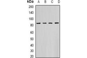 Western blot analysis of HADHA expression in K562 (A), PC3 (B), Hela (C), mouse heart (D) whole cell lysates. (HADHA anticorps)