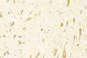 Immunohistochemistry analysis of paraffin-embedded mouse spinal cord using ADAMTS4 (ABIN7072947) at dilution of 1: 3000 (ADAMTS4 anticorps)