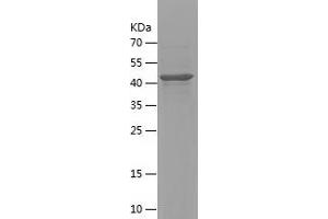 Western Blotting (WB) image for Diacylglycerol Kinase, alpha 80kDa (DGKA) (AA 341-555) protein (His-IF2DI Tag) (ABIN7122651)