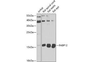 Western blot analysis of extracts of various cell lines, using F antibody  at 1:1000 dilution. (FABP12 anticorps  (AA 1-140))