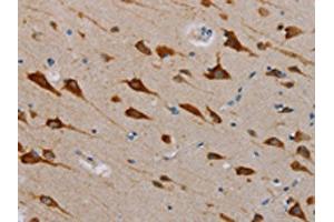 The image is immunohistochemistry of paraffin-embedded Human brain tissue using ABIN7131284(TAB3 Antibody) at dilution 1/25.