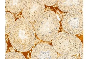ABIN6266053 and ABIN6273349 at 1/100 staining Mouse testis tissue by IHC-P.