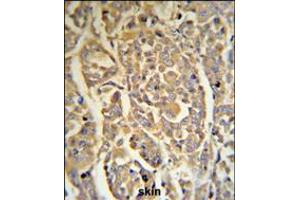 DCD Antibody (RB18706) IHC analysis in formalin fixed and paraffin embedded human skin tissue followed by peroxidase conjugation of the secondary antibody and DAB staining.