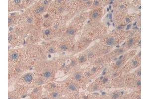 Detection of SMC3 in Human Liver Tissue using Polyclonal Antibody to Structural Maintenance Of Chromosomes Protein 3 (SMC3)