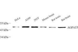 Western blot analysis of AGPAT5 (ABIN7072838) at dilution of 1: 300 (AGPAT5 anticorps)