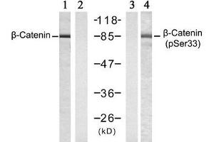 Western blot analysis of extracts from SW 626 cells , untreated or treated with Calyculin A (50nM, 30min), using β-Catenin (Ab-33) antibody (E021211, Lane 1 and 2) and β-Catenin (phospho-Ser33) antibody (E011218, Lane 3 and 4). (beta Catenin anticorps  (pSer33))