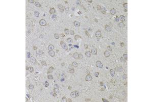 Immunohistochemistry of paraffin-embedded mouse brain using CD59 antibody. (CD59 anticorps)