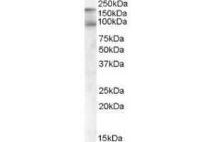 Western Blotting (WB) image for anti-CUB Domain Containing Protein 1 (CDCP1) (C-Term) antibody (ABIN2465191) (CDCP1 anticorps  (C-Term))