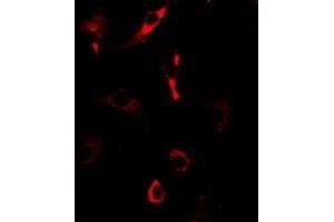 Immunofluorescent analysis of Nop30 staining in U2OS cells. (NOL3 anticorps)