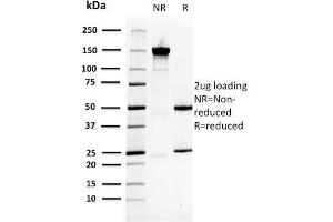 SDS-PAGE Analysis Purified HSP27 Mouse Monoclonal Antibody (CPTC-HSPB1-2).