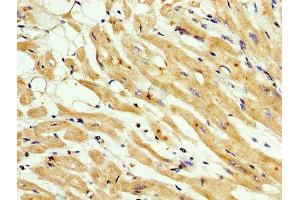 IHC image of ABIN7159457 diluted at 1:200 and staining in paraffin-embedded human heart tissue performed on a Leica BondTM system.