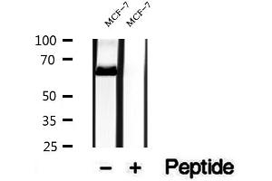 Western blot analysis of extracts of MCF-7 cells, using NR1D1 antibody. (NR1D1 anticorps  (N-Term))