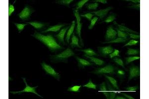 Immunofluorescence of monoclonal antibody to CHRNB3 on HeLa cell.