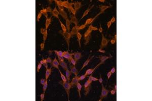 Immunofluorescence analysis of NIH/3T3 cells using UBQLNL antibody (ABIN7271125) at dilution of 1:100.