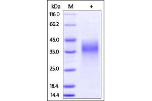 Mouse LIF, His Tag on SDS-PAGE under reducing (R) condition. (LIF Protein (AA 24-203) (His tag))