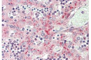 Rabbit Anti-F13B antibody  Formalin Fixed Paraffin Embedded Tissue: Human Fetal Liver Primary antibody Concentration: 1:100 Secondary Antibody: Donkey anti-Rabbit-Cy3 Secondary Antibody Concentration: 1:200 Magnification: 20x Exposure Time: 0.