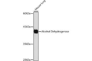 Western blot analysis of extracts of Mouse lung, using Alcohol Dehydrogenase Rabbit mAb (ABIN7265529) at 1:1000 dilution. (ADH1A anticorps)