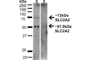 Western blot analysis of Human HeLa and HEK293T cell lysates showing detection of ~57. (SLC2A2 anticorps  (C-Term) (PE))