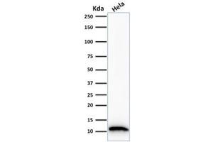 Western blot testing of human HeLa cell lysate with FSP1 antibody. (s100a4 anticorps)
