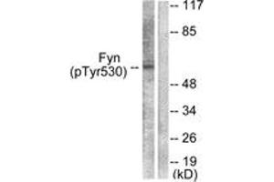 Western blot analysis of extracts from 293 cells treated with H2O2 100uM 15', using Fyn (Phospho-Tyr530) Antibody. (FYN anticorps  (pTyr531))