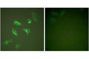 Immunofluorescence analysis of HeLa cells, using 14-3-3 zeta (Ab-58) Antibody. (14-3-3 zeta anticorps  (AA 24-73))