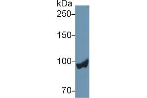 Western blot analysis of Rat Liver lysate, using Rat PYGL Antibody (2 µg/ml) and HRP-conjugated Goat Anti-Rabbit antibody ( (PYGL anticorps  (AA 73-267))