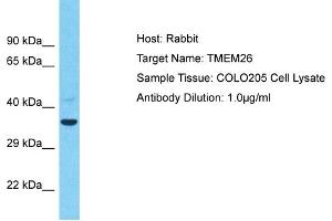 Host: Rabbit Target Name: TMEM26 Sample Type: COLO205 Whole Cell lysates Antibody Dilution: 1. (TMEM26 anticorps  (C-Term))