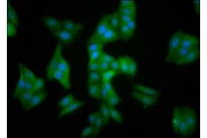 Immunofluorescence staining of HepG2 cells with ABIN7159657 at 1:100, counter-stained with DAPI. (MMADHC anticorps  (AA 26-142))