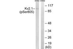 Western blot analysis of extracts from K562 cells treated with TNF 200ng/ml 30', using Kv2. (Kv2.1/KCNB1 anticorps  (pSer805))