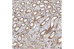 IHC analysis of SEC31A using anti-SEC31A antibody (ABIN7599630).