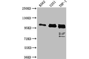 Western Blot Positive WB detected in: K562 whole cell lysate, U-251 whole cell lysate, THP-1 whole cell lysate All lanes: ITCH antibody at 1:1000 Secondary Goat polyclonal to rabbit IgG at 1/50000 dilution Predicted band size: 103, 99, 87 kDa Observed band size: 103 kDa (Recombinant ITCH anticorps)