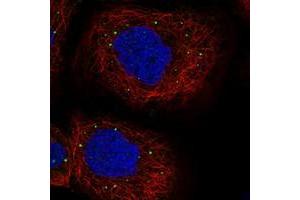 Immunofluorescent staining of human cell line A-431 with PATL1 polyclonal antibody  at 1-4 ug/mL dilution shows positivity in vesicles. (PATL1 anticorps)