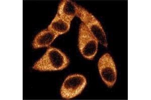 Immunofluorescence staining of HeLa cells