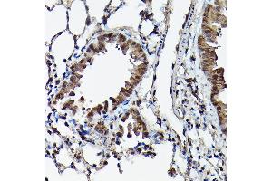 Immunohistochemistry of paraffin-embedded mouse lung using Ataxin-3  Rabbit pAb (ABIN3021828, ABIN3021829, ABIN3021830, ABIN1512615 and ABIN6216049) at dilution of 1:100 (40x lens).