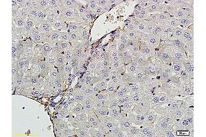 Formalin-fixed and paraffin embedded rat liver tissue labeled with Anti-CXCL13 Polyclonal Antibody, Unconjugated (ABIN706691) at 1:200 followed by conjugation to the secondary antibody and DAB staining (CXCL13 anticorps  (AA 23-109))