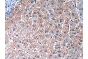 DAB staining on IHC-P; Samples: Human Liver Tissue