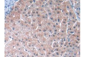 DAB staining on IHC-P; Samples: Human Liver Tissue (TUBE1 anticorps  (AA 236-473))
