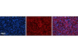 Rabbit Anti-HERC4 Antibody   Formalin Fixed Paraffin Embedded Tissue: Human Liver Tissue Observed Staining: Cytoplasm in hepatocytes Primary Antibody Concentration: N/A Other Working Concentrations: 1:600 Secondary Antibody: Donkey anti-Rabbit-Cy3 Secondary Antibody Concentration: 1:200 Magnification: 20X Exposure Time: 0.