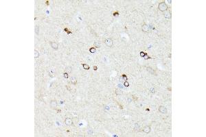 Immunohistochemistry of paraffin-embedded rat brain using CCDC6 antibody (ABIN7266442) at dilution of 1:100 (40x lens). (CCDC6 anticorps  (AA 55-222))