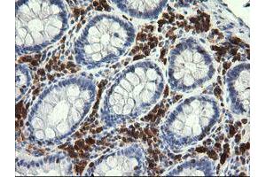 Image no. 1 for anti-Phosphoinositide-3-Kinase, Catalytic, gamma Polypeptide (PIK3CG) antibody (ABIN1500202)