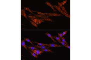 anti-rho GTPase Activating Protein 30 (ARHGAP30) (AA 485-585) antibody