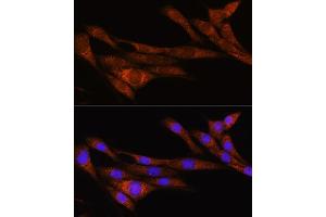 Immunofluorescence analysis of NIH/3T3 cells using  Rabbit pAb (ABIN7269965) at dilution of 1:100. (ARHGAP30 anticorps  (AA 485-585))
