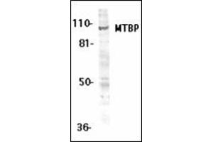 Western blot analysis of MTBP expression in K562 whole cell lysates with this product at 1 μg /ml.