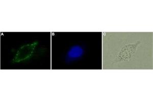 Expression of CB2 receptor in human LNCaP - Immunocytochemical staining of living human prostate carcinoma cells (LNCaP). (CNR2 anticorps  (Extracellular))