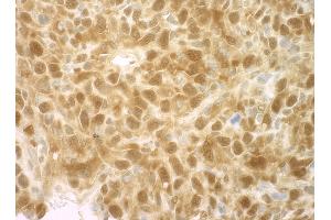 Immunohistochemistry (IHC) image for anti-Eukaryotic Translation Initiation Factor 4E Binding Protein 1 (EIF4EBP1) (C-Term) antibody (ABIN7448395) (eIF4EBP1 anticorps  (C-Term))