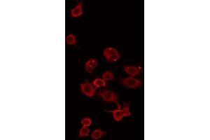 ABIN6275340 staining Hela by IF/ICC. (ZDHHC15 anticorps  (C-Term))